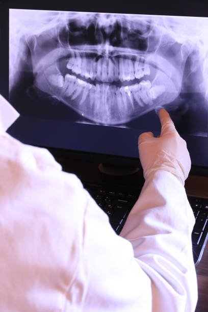 Best Emergency Treatment for Oral Infections in Kensington, CA