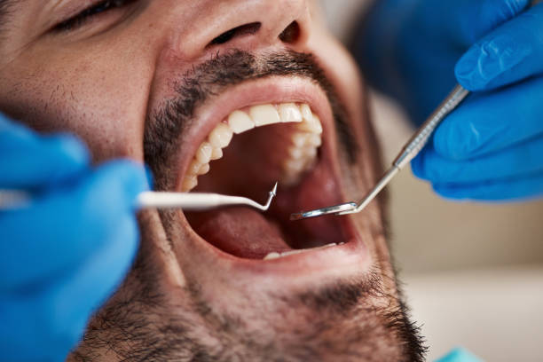 Best Emergency Treatment for Jaw Pain or Injury in Kensington, CA