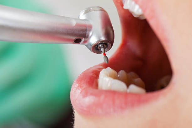 Best Urgent Dental Care for Toothaches in Kensington, CA